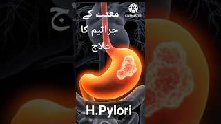 HPylori Helicobacter Pylori Signs Symptoms Lab Test and Treatment hpylori treatment shorts [upl. by Eniamej]