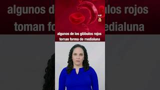 Qué es la anemia falciforme y a quién afecta esta enfermedad de la sangre [upl. by Flory]