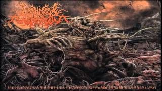 FULL ALBUM Postcoital Ulceration  Continuation of Defective Existence After Multiple [upl. by Aiuqat]