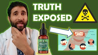 Dentitox Pro Reviews  🔴 My Honest Dentitox Pro Supplement Review 2022 🔴  Dentitox Pro Review [upl. by Anizor]