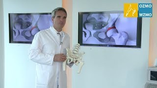 Prof Dr Diehl LabrumKnorpelschaden Hüftgelenk amp minimalinvasive Versorgung [upl. by Jodi]