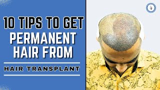 How to grow your hair permanently  10  tips to Get Permanent hair from Hair Transplant hfhg [upl. by Milstone26]