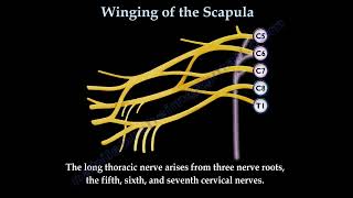 WINGING OF THE SCAPULALONG THORACIC NERVE  Everything You Need To Know  Dr Nabil Ebraheim [upl. by Latt14]