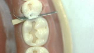 Cl II Cavity preparation Lower 2nd Premolar GV Black Dr Ahmed Sleibi [upl. by Engenia]