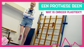 WAT ALS 1 BEEN VEEL KORTER IS DAN DE ANDERE  TOPDOKS EXTRA [upl. by Olin]