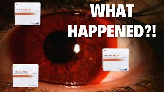 The Disappearance of the Nike MaxSight Lenses [upl. by Nolrev350]