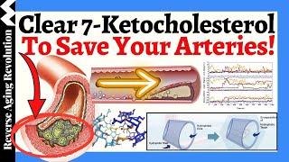 Clear 7Ketocholesterol To SAVE Your Arteries A NOVEL Approach To Heart Health [upl. by Okihcim932]