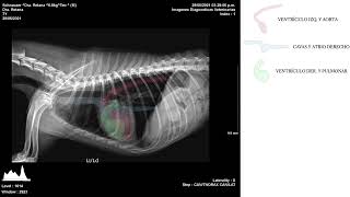 ANATOMIA RADIOLÓGICA TORÁCICA [upl. by Nigam]