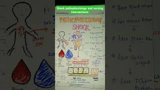 shock pathophysiology and nursing interventionsnursingnotesnursinglecturebscnurshing [upl. by Kcorb839]