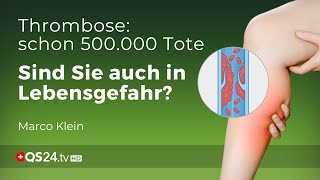 Thrombose – Prophylaxe und Behandlung  Kleinsche Felder  Marco Klein  QS24 Gesundheitsfernsehen [upl. by Atiuqrahc725]