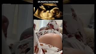 9 Months Pregnancy Baby Movement On Ultrasound Scan [upl. by Emad]