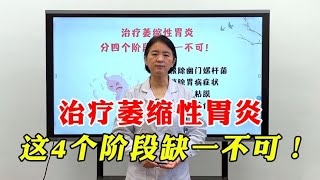 萎缩性胃炎，治疗上分4个阶段，不同阶段不同方法，缺一不可！ [upl. by Vlad]