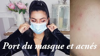 PORT DU MASQUE 😷 et ACNÉ solutions MASCNÉ [upl. by Nimrac]