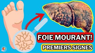 LE FOIE est en train de MOURIR 15 Signes étranges de DOMMAGES AU FOIE [upl. by Laundes]