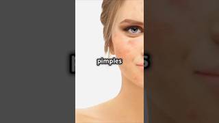 clear skin in 7 days no pimples skincare pimple [upl. by Tarr]