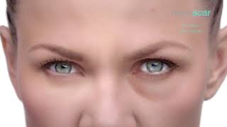 Remescar Eye Bags amp Dark Circles TV Spot [upl. by Suivat342]