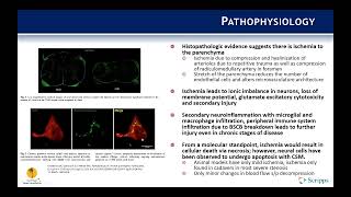 Indications Cervical Spondylotic Myelopathy  Benjamin Kafka MD [upl. by Nerrej]