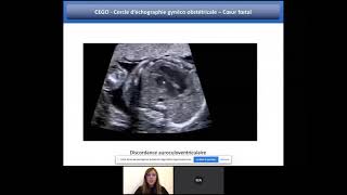 Généralités sur le coeur foetal  Webinaire de formation en échographie [upl. by Yraccaz]