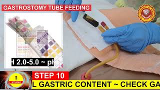 GASTROSTOMY TUBE FEEDING [upl. by Mirabelle802]