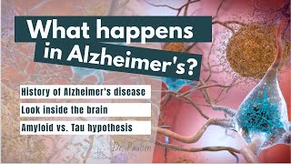 What happens to the brain in Alzheimers disease  Amyloid amp Tau explained [upl. by Nannette975]