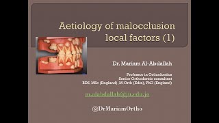 Dr Mariam Aetiology of Malocclusion Local factors 1 [upl. by Aitnauq96]