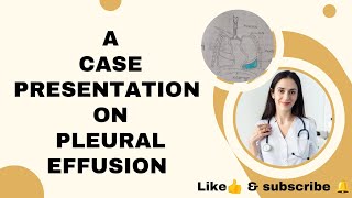 case presentation on pleural Effusion pleuraleffusion casepresentation subscribe nursingstudent [upl. by Cutter]