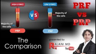 PRF vs PRP We Compare [upl. by Rutan]