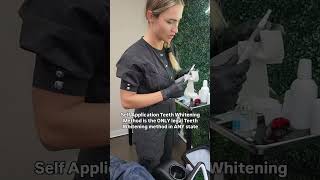 Teeth Whitening Self Application Method [upl. by Sarson988]