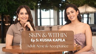 Skin amp Within ft Kusha Kapila [upl. by Haslett]