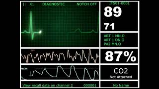 Hospital Monitor with FlatLine L HD [upl. by Ydneh]