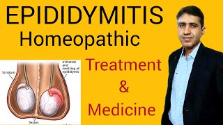 Epididymitis SymptomsCauses and Treatment Homeopathic medicine Testicular Pain DrRamdeo Lamoria [upl. by Amada135]