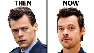 Harry Styles Hair Transplant  Plastic Surgery Analysis [upl. by Latif363]