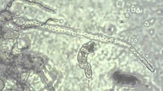 Catenaria anguillulae zoospore discharge [upl. by Selwin]