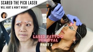 How I got my microblading removed Before amp AfterPart 2 [upl. by Trill]