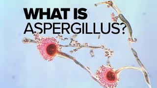 What is Aspergillus mold [upl. by Delila494]