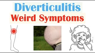 Weird Symptoms of Diverticulitis  Atypical Clinical Features of Diverticulitis [upl. by Etnud]