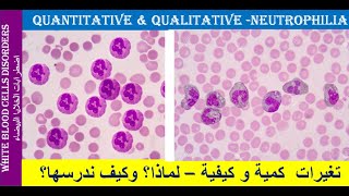 lecture 22 Neutrophilia Quantitative and Qualitative Changes [upl. by Eimia]