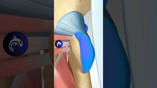 Learn about Hip Bursitis hip bursitis orthopedicsurgeon [upl. by Darrick]