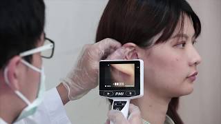 HD Digital Otoscope  Instructions for Usage  CEI Technology Inc [upl. by Attenat]