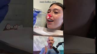 What’s being pulled out from up her nose 🤔 👃 credit vstell on TikTok doctor satisfying [upl. by Notlek]