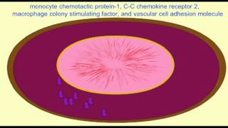 HEART DISEASE MACROPHAGES IN PLAQUES [upl. by Adnarem]