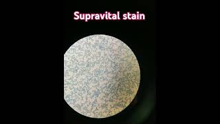 Supra vital stain  For reticulocyte count 💕 [upl. by Acined]