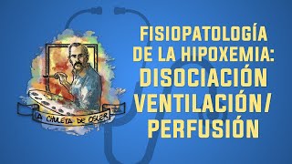 Hipoxemia Disociación ventilaciónperfusión [upl. by Salomie]