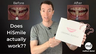 HiSmile Review By A Dentist Dr Grant McGrath [upl. by Deryl731]