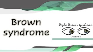 Brown syndrome [upl. by Berte]