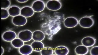 LIVE BLOOD ANALYSIS NEUTROPHILS PART 2 [upl. by Benco913]