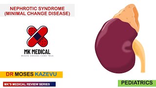 Nephrotic Syndrome Minimal Change Disease [upl. by Najib]