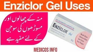 Enziclor Gel uses and benefits in urdu  Enziclor Gel for sore tongue and gums [upl. by Esmerelda]