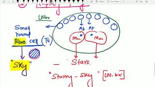 BURKITT s Lymphoma by Dr Devesh Mishra [upl. by Clemmie268]