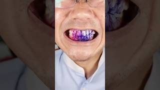 New Teeth Whiting Gum asmr dentist satisfying teethwhitening candy tasty [upl. by Lotty]